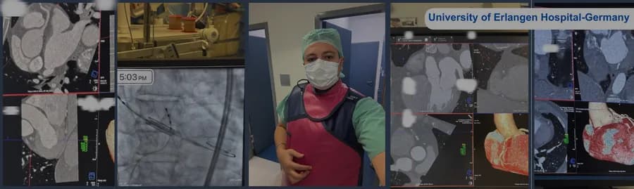 صور تصوير القلب المتقدم بمستشفى جامعة إرلانغن في ألمانيا